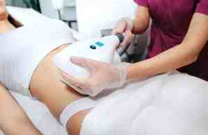 Woman receiving CoolSculpting treatment