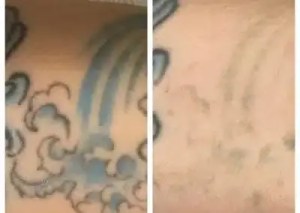 waves before and after