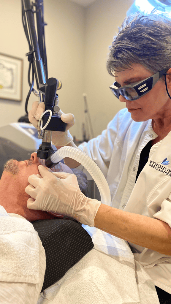 CO2 laser resurfacing treatment being performed at Well Labs+ Medspa Wyndhurst in Lynchburg, VA